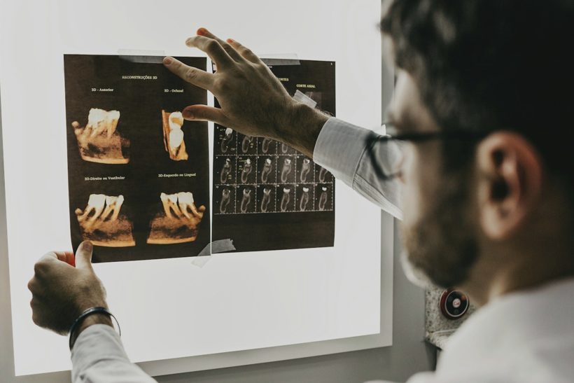 Prótese dentária fixa e removível na Odontoclinic Sumaré